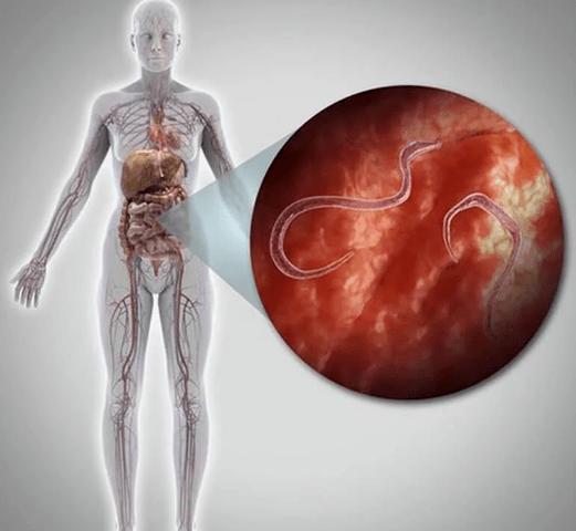 Parasiten im menschlichen Körper