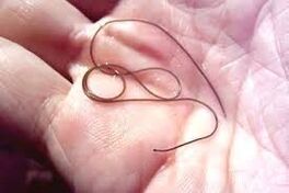 Parasit in Ihrer Handfläche