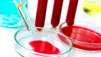 Blutuntersuchung für Parasiten