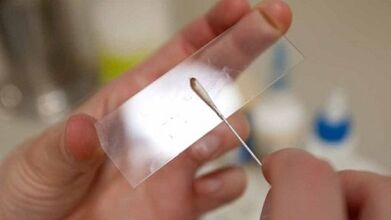 Calais -Analyse zur Identifizierung von Parasiten