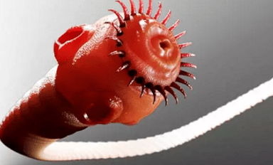 Was Parasiten im menschlichen Körper leben können