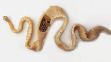 Wie man das Vorhandensein von Parasiten im Körper entdeckt