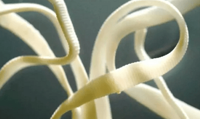 wie man Parasiten aus dem menschlichen Körper entfernen