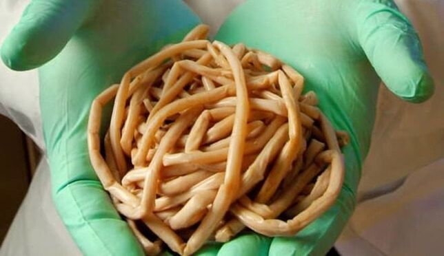 Entfernung von Parasiten aus dem Körper