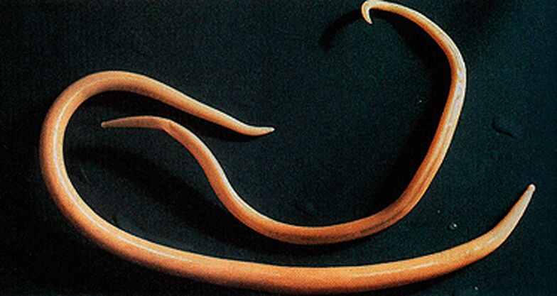 Wurmparasit aus dem menschlichen Körper